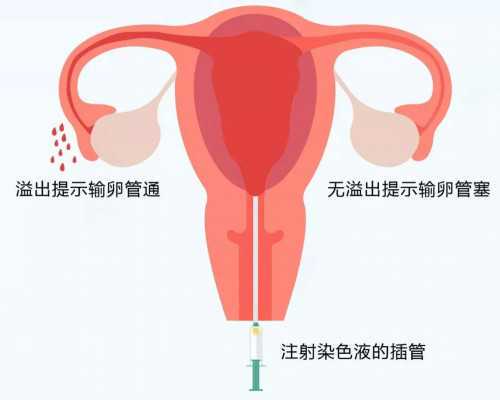 第二名:甘肃省妇幼保健院,2026甘肃省试管医院收费标准