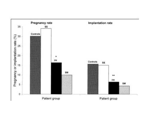 甘肃做三次试管婴儿需要多少钱?,甘肃试管婴儿多少钱一次
