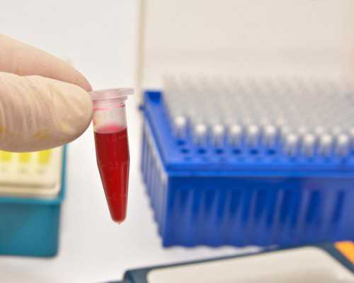 甘肃试管婴儿费用需要多少？,2023甘肃省妇幼做试管成功率