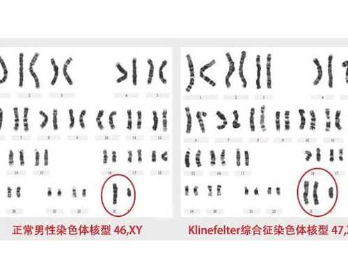 甘肃做试管婴儿多少钱？,甘肃南山做输卵管堵塞造影多少钱