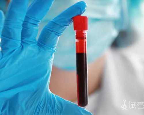 兰州正规代孕中介 兰州做试管哪家医院好 ‘32周双顶径看男女’