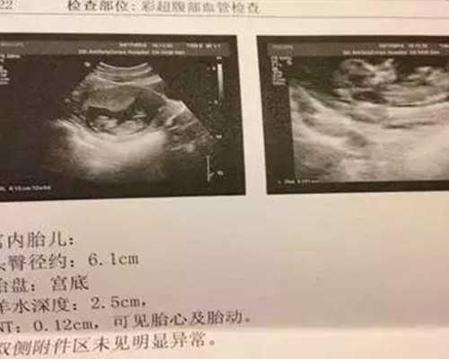 2023湖南长沙不用等的公立供卵机构一次成功率高吗？