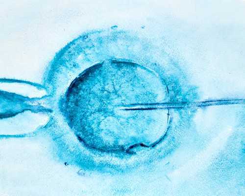 深圳助孕价格,深圳代生男孩,深圳代生妈妈,想做二代试管选性别的姐妹，你们该