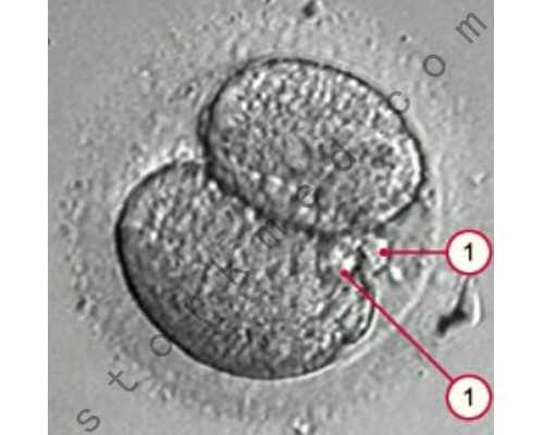 嘉兴正规供卵费用 2022嘉兴试管婴儿医院排名 ‘24周b超看男女’